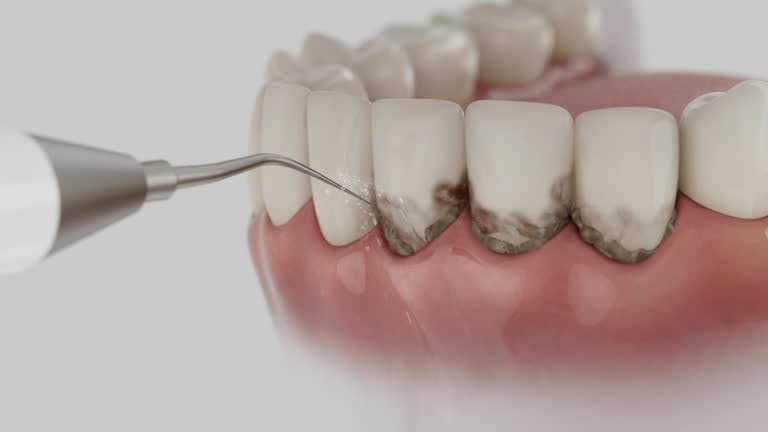 Trusted Dental Crowns And Bridges service in Beeville, TX - Dentist Open Now